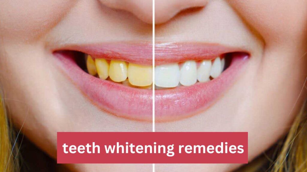 teeth whitening remedies 